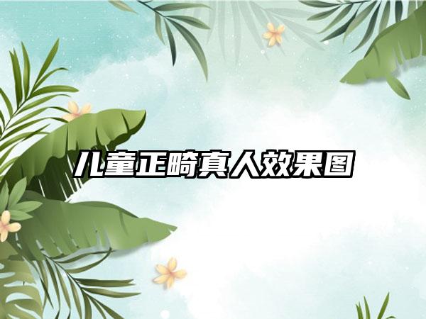 儿童正畸真人效果图