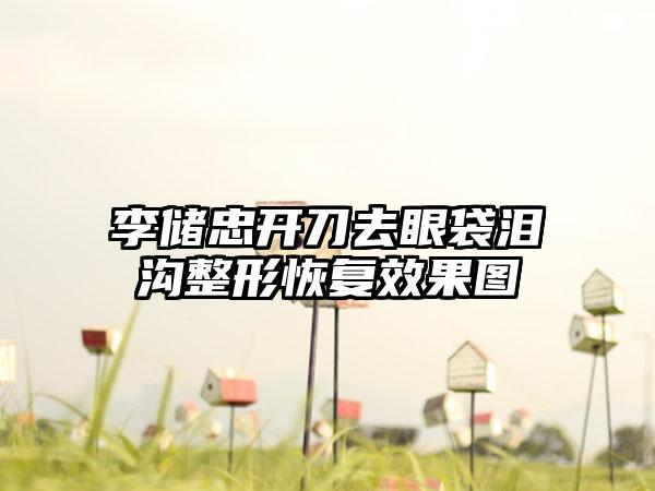 李储忠开刀去眼袋泪沟整形恢复效果图