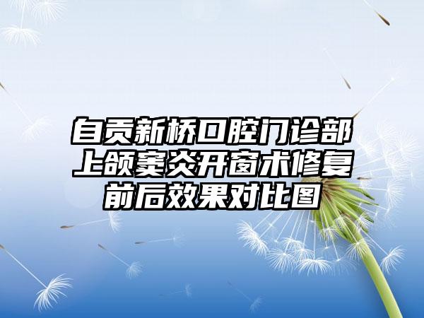 自贡新桥口腔门诊部上颌窦炎开窗术修复前后效果对比图
