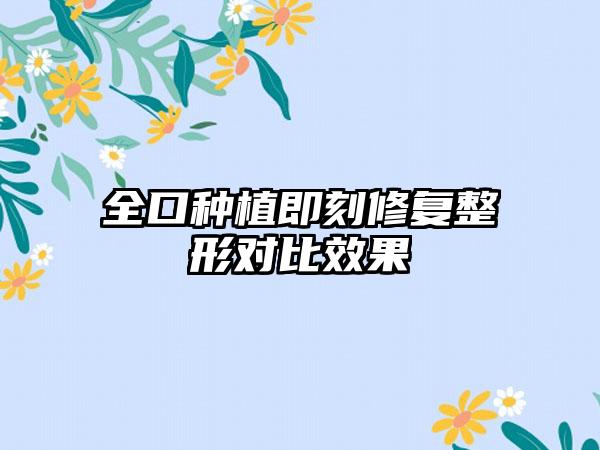 全口种植即刻修复整形对比效果