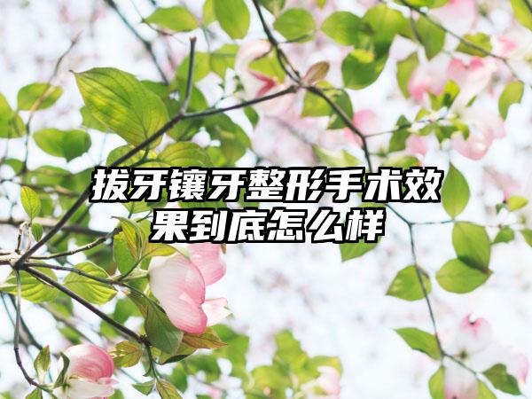 拔牙镶牙整形手术效果到底怎么样