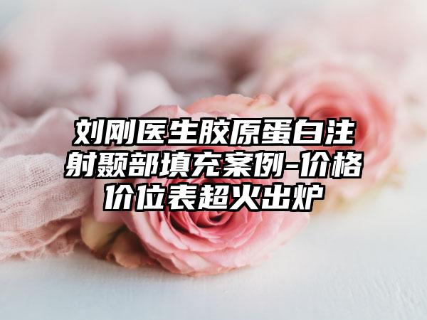 刘刚医生胶原蛋白注射颞部填充案例-价格价位表超火出炉