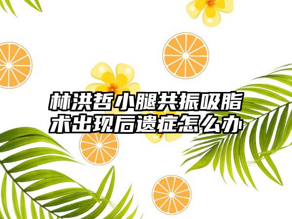 林洪哲小腿共振吸脂术出现后遗症怎么办