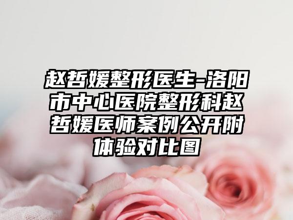 赵哲媛整形医生-洛阳市中心医院整形科赵哲媛医师案例公开附体验对比图