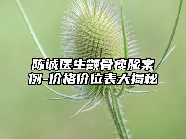 陈诚医生颧骨瘦脸案例-价格价位表大揭秘