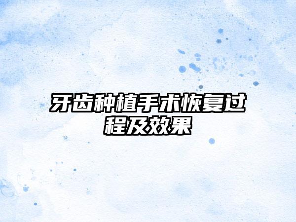 牙齿种植手术恢复过程及效果