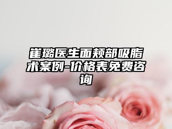 崔璐医生面颊部吸脂术案例-价格表免费咨询