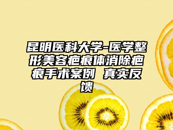 昆明医科大学-医学整形美容疤痕体消除疤痕手术案例 真实反馈